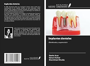 Bild des Verkufers fr Implantes dentales zum Verkauf von moluna