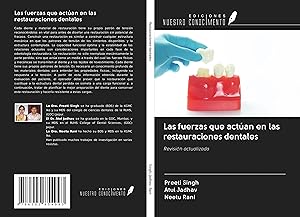 Seller image for Las fuerzas que actan en las restauraciones dentales for sale by moluna