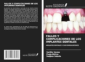 Seller image for FALLOS Y COMPLICACIONES DE LOS IMPLANTES DENTALES for sale by moluna