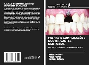 Seller image for FALHAS E COMPLICAES DOS IMPLANTES DENTRIOS for sale by moluna