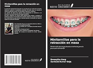Seller image for Minitornillos para la retraccin en masa for sale by moluna