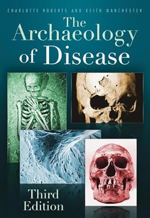 Bild des Verkufers fr The Archaeology of Disease : Third Edition zum Verkauf von AHA-BUCH GmbH