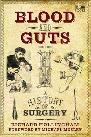 Bild des Verkufers fr Blood and Guts : A History of Surgery zum Verkauf von AHA-BUCH GmbH