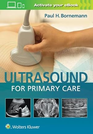 Bild des Verkufers fr Ultrasound for Primary Care zum Verkauf von AHA-BUCH GmbH