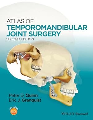 Bild des Verkufers fr Atlas of Temporomandibular Joint Surgery zum Verkauf von AHA-BUCH GmbH