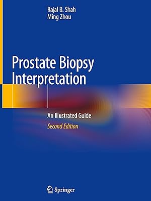 Seller image for Prostate Biopsy Interpretation for sale by moluna