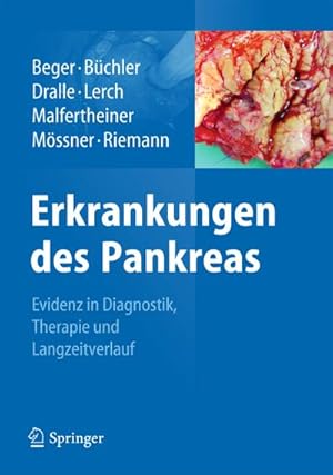 Imagen del vendedor de Erkrankungen des Pankreas : Evidenz in Diagnostik, Therapie und Langzeitverlauf a la venta por AHA-BUCH GmbH