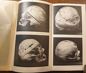 Immagine del venditore per Sulla Divisione del Parietale. Tre osservazioni originali in crani di Idioti. venduto da Libreria Antiquaria Dentis (ALAI - ILAB)
