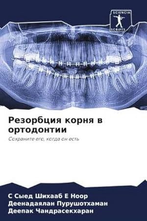 Seller image for Rezorbciq kornq w ortodontii : Sohranite ego, kogda on est' for sale by AHA-BUCH GmbH