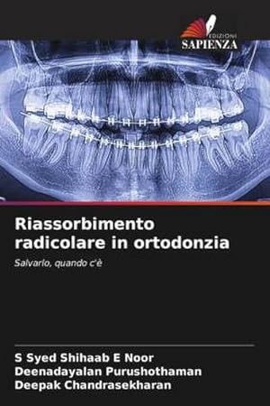 Seller image for Riassorbimento radicolare in ortodonzia : Salvarlo, quando c' for sale by AHA-BUCH GmbH