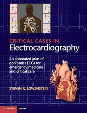 Bild des Verkufers fr Critical Cases in Electrocardiography zum Verkauf von AHA-BUCH GmbH