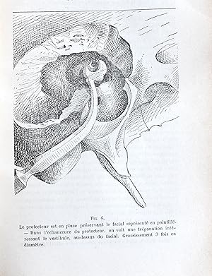 Chirurgie du labyrinthe, In : Annales des maladies de l'oreille et du larynx, 1905, T. XXXI, N° 9.