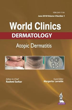 Seller image for WORLD CLINICS-ATOPIC DERMATITIS (JUNE 2018, VOL.04 ISSUE 1) for sale by AHA-BUCH GmbH