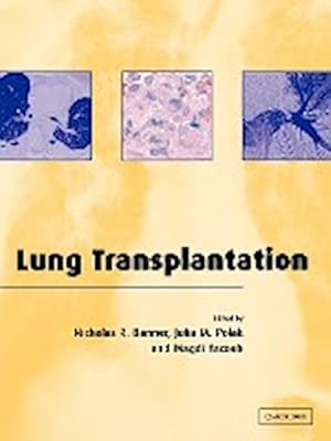 Bild des Verkufers fr Lung Transplantation zum Verkauf von AHA-BUCH GmbH