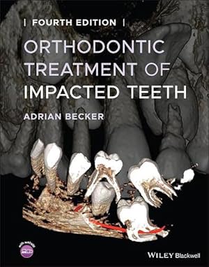 Image du vendeur pour Orthodontic Treatment of Impacted Teeth (Hardcover) mis en vente par AussieBookSeller