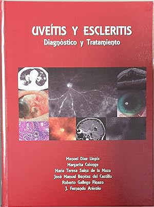 Imagen del vendedor de Uvetis y escleritis. Diagnstico y tratamiento a la venta por Los libros del Abuelo