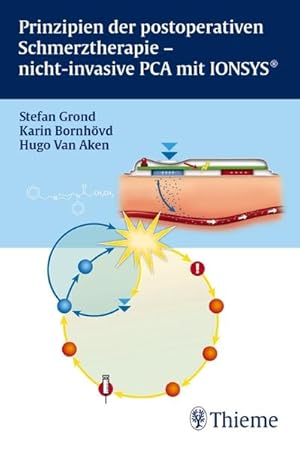 Prinzipien der postoperativen Schmerztherapie - nicht-invasive PCA mit IONSYS®