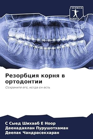 Seller image for Rezorbciq kornq w ortodontii for sale by moluna