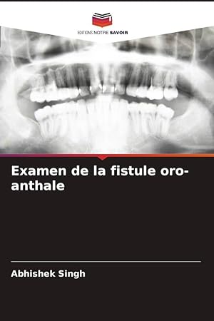 Image du vendeur pour Examen de la fistule oro-anthale mis en vente par moluna