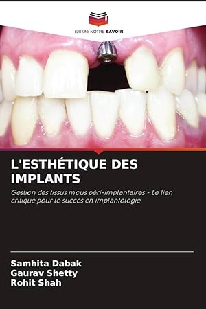 Bild des Verkufers fr L\ ESTHTIQUE DES IMPLANTS zum Verkauf von moluna