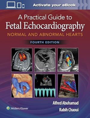 Image du vendeur pour Practical Guide to Fetal Echocardiography : Normal and Abnormal Hearts mis en vente par GreatBookPrices