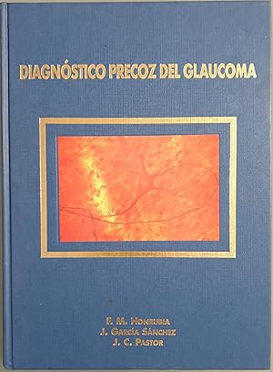 Imagen del vendedor de Diagnstico precoz del glaucoma a la venta por Los libros del Abuelo