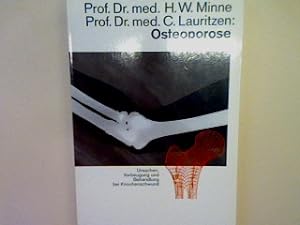 Seller image for Osteoporose for sale by books4less (Versandantiquariat Petra Gros GmbH & Co. KG)