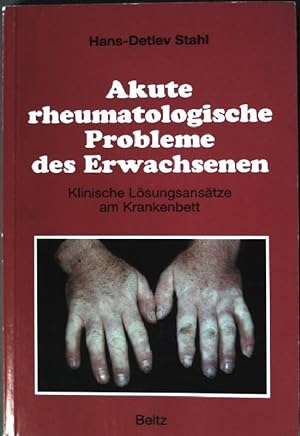 Seller image for Akute rheumatologische Probleme des Erwachsenen: Klinische Lsungsanstze am Krankenbett. for sale by books4less (Versandantiquariat Petra Gros GmbH & Co. KG)