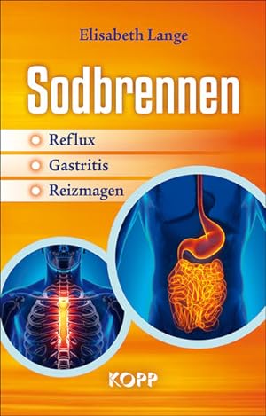 Seller image for Sodbrennen: Reflux - Gastritis - Reizmagen for sale by Versandantiquariat Felix Mcke