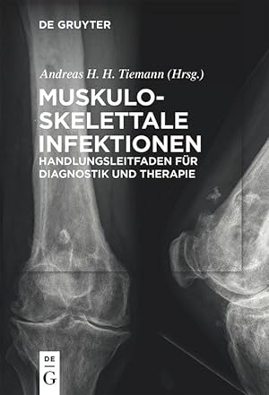 Bild des Verkufers fr Muskuloskelettale Infektionen zum Verkauf von moluna
