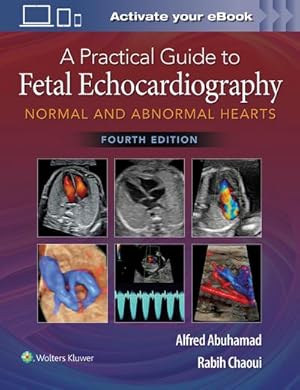 Image du vendeur pour A Practical Guide to Fetal Echocardiography mis en vente par BuchWeltWeit Ludwig Meier e.K.