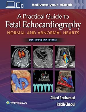 Image du vendeur pour A Practical Guide to Fetal Echocardiography mis en vente par moluna