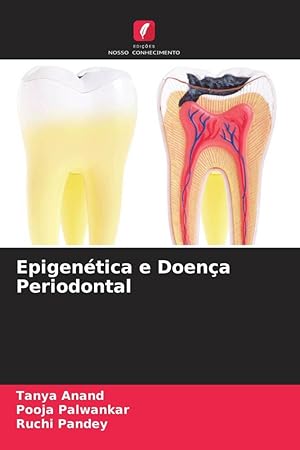 Seller image for Epigentica e Doena Periodontal for sale by moluna