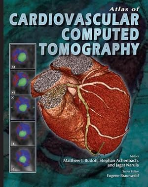 Seller image for Atlas of Cardiovascular Computed Tomography. for sale by Antiquariat Thomas Haker GmbH & Co. KG