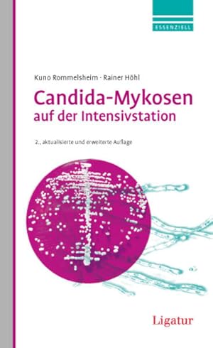 Candida-Mykosen auf der Intensivstation: Anidulafungin in der Primärtherapie