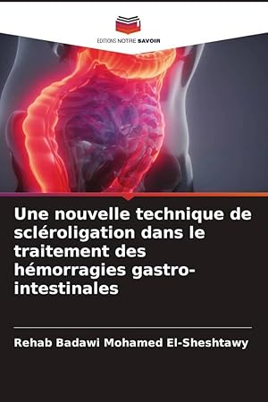 Bild des Verkufers fr Une nouvelle technique de sclroligation dans le traitement des hmorragies gastro-intestinales zum Verkauf von moluna