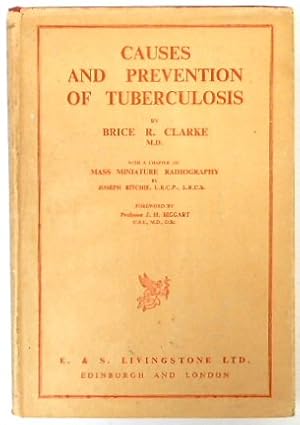 Causes and Prevention of Tuberculosis