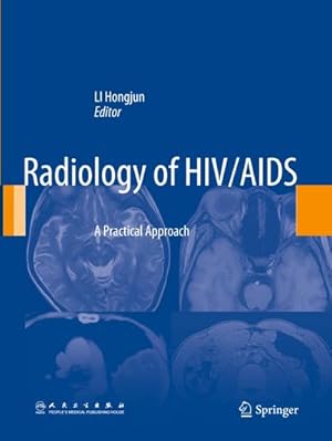 Bild des Verkufers fr Radiology of HIV/AIDS : A Practical Approach zum Verkauf von AHA-BUCH GmbH