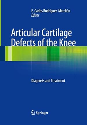Bild des Verkufers fr Articular Cartilage Defects of the Knee : Diagnosis and Treatment zum Verkauf von AHA-BUCH GmbH