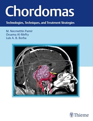 Seller image for Chordomas : Technologies, Techniques, and Treatment Strategies for sale by GreatBookPricesUK