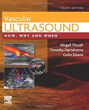 Image du vendeur pour Vascular Ultrasound: How, Why and When [Hardcover ] mis en vente par booksXpress