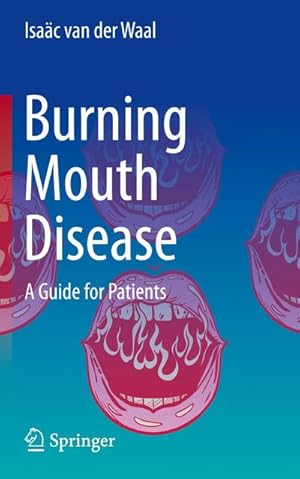 Bild des Verkufers fr Burning Mouth Disease : A Guide for Patients zum Verkauf von AHA-BUCH GmbH