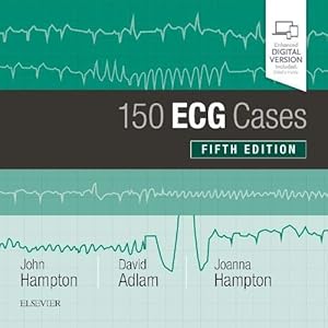 Seller image for 150 ECG Cases (150 ECG Problems) by Hampton DM MA DPhil FRCP FFPM FESC, John, Adlam BA BM BCh DPhil FRCP FESC, David, Hampton MD MA BM BCh FRCP, Joanna [Paperback ] for sale by booksXpress