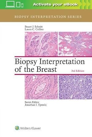 Seller image for Biopsy Interpretation of the Breast (Biopsy Interpretation Series) by Schnitt MD, Stuart J., Collins MD, Laura C. [Hardcover ] for sale by booksXpress