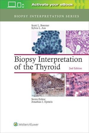 Image du vendeur pour Biopsy Interpretation of the Thyroid (Biopsy Interpretation Series) by Boerner MD, Scott L., Asa MD, Sylvia L. [Hardcover ] mis en vente par booksXpress