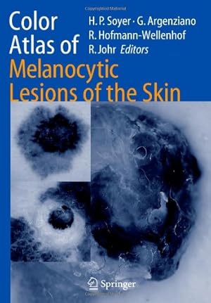Seller image for Color Atlas of Melanocytic Lesions of the Skin [Paperback ] for sale by booksXpress