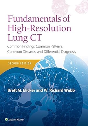 Imagen del vendedor de Fundamentals of High-Resolution Lung CT: Common Findings, Common Patterns, Common Diseases and Differential Diagnosis (Pocket Notebook) by Elicker MD, Brett M, Webb, W. Richard [Paperback ] a la venta por booksXpress