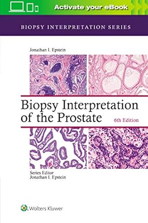 Imagen del vendedor de Biopsy Interpretation of the Prostate (Biopsy Interpretation Series) by Epstein, Jonathan I. [Hardcover ] a la venta por booksXpress