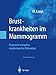 Seller image for Brustkrankheiten im Mammogramm: Diagnostik und pathomorphologische Bildanalyse (German Edition) [Soft Cover ] for sale by booksXpress