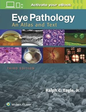 Image du vendeur pour Eye Pathology: An Atlas and Text by Eagle Jr. MD, Ralph C. [Hardcover ] mis en vente par booksXpress